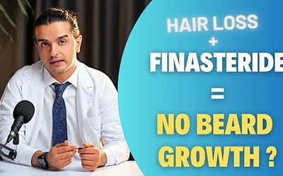 Finasteride is killing my Beard