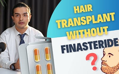 Finasteride and Hair Transplants: How to Use Them Together for Best Results