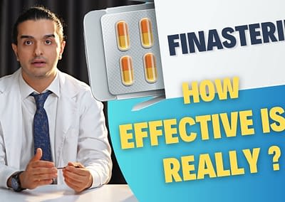 Finasteride : How Effective Is It Really ?