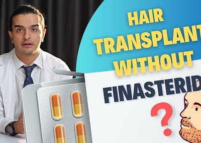 Finasteride and hair transplants: How to use them together for best results